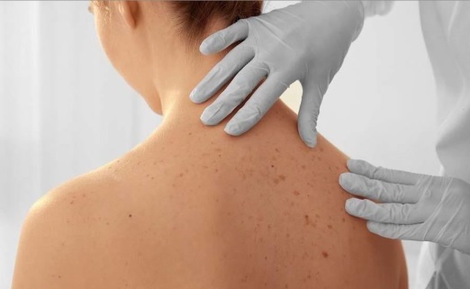 Fundación Mexicana para la Dermatología