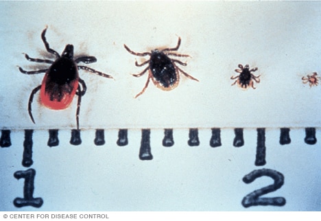 Día de la Enfermedad de Lyme